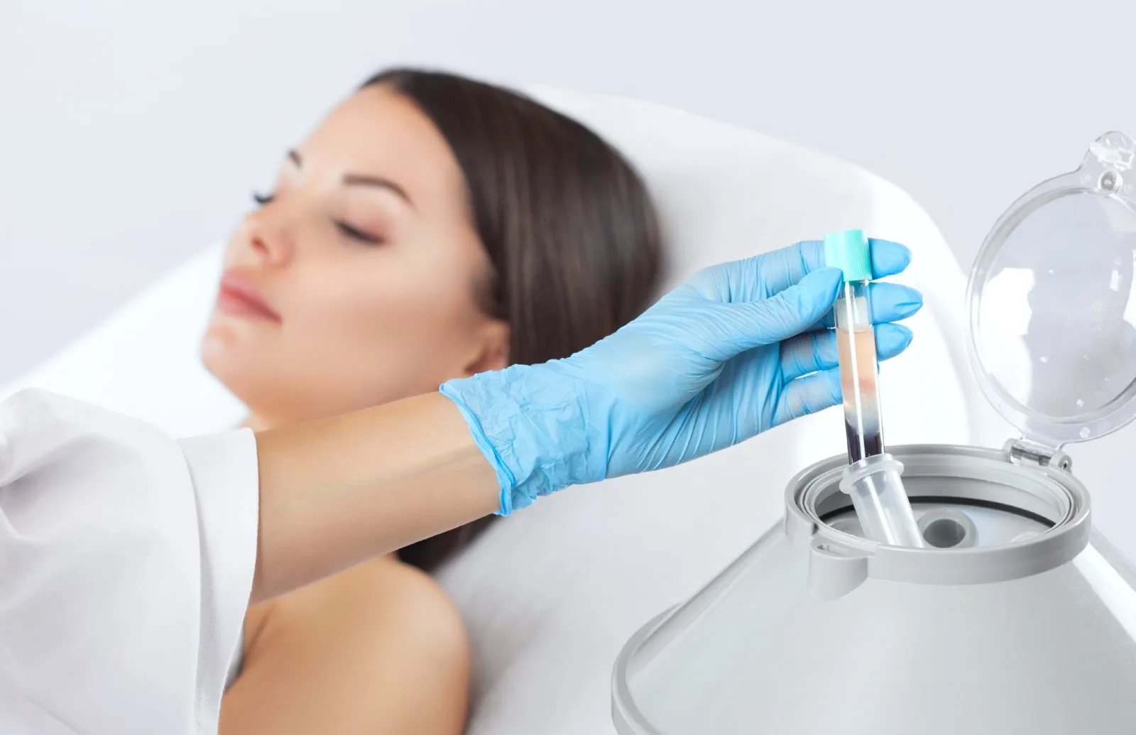 PRP Treatments