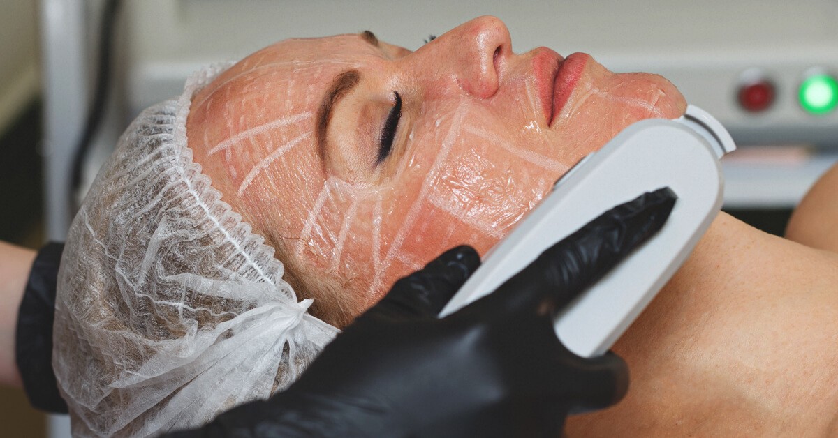 Skin Works Medical Spa provides the best ultherapy and skin tightening in Torrance and south bay los angeles