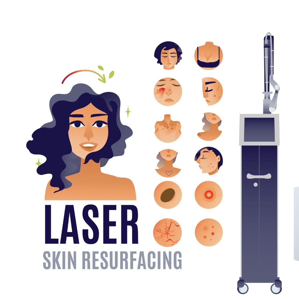 what is laser resurfacing?