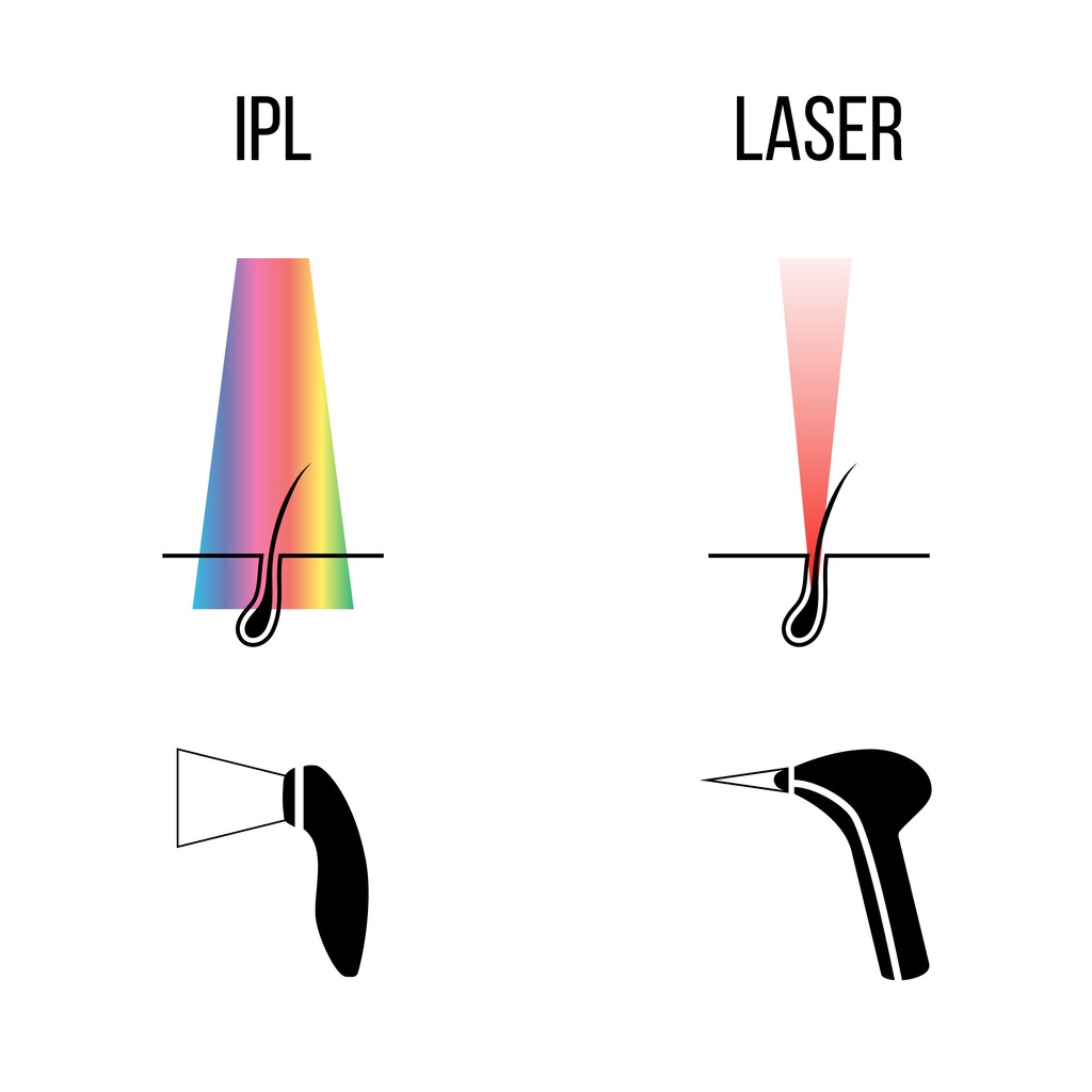 IPL photofacial treatment is very versatile 
