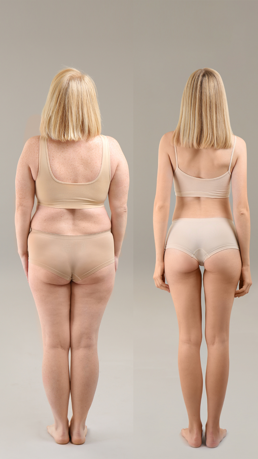 How To Prepare Your Patient For Liposuction Recovery