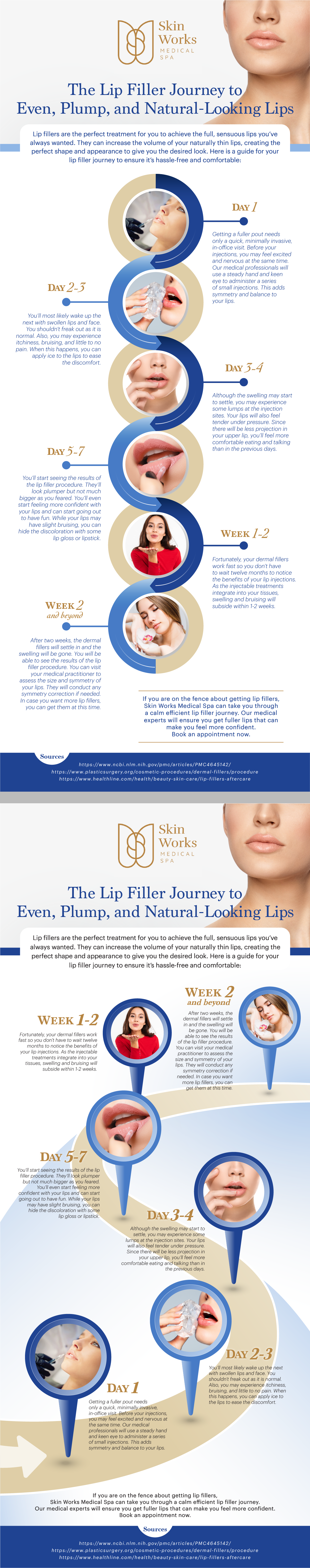 Lip Filler Infographic