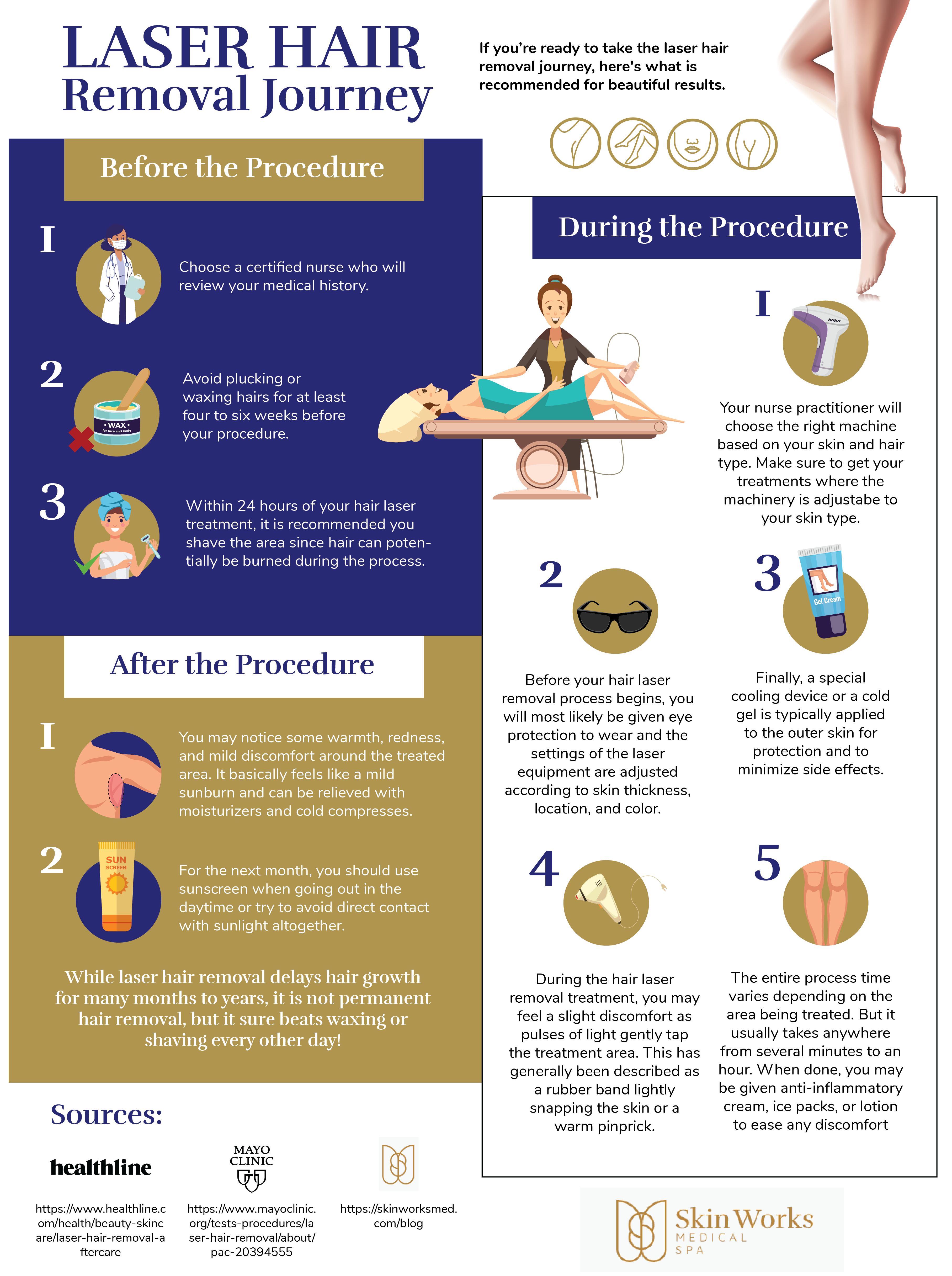laser hair removal infographic