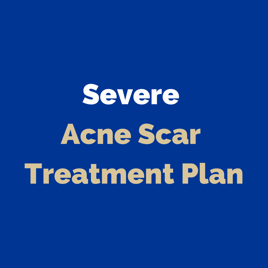 acne scar treatment redondo beach