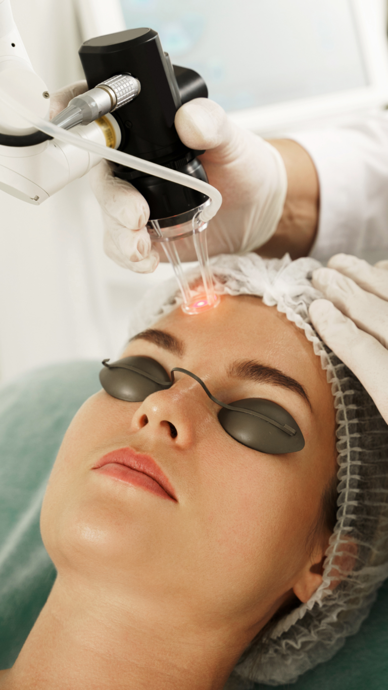 Erbium Laser Skin Works Medical Spa Torrance, CA