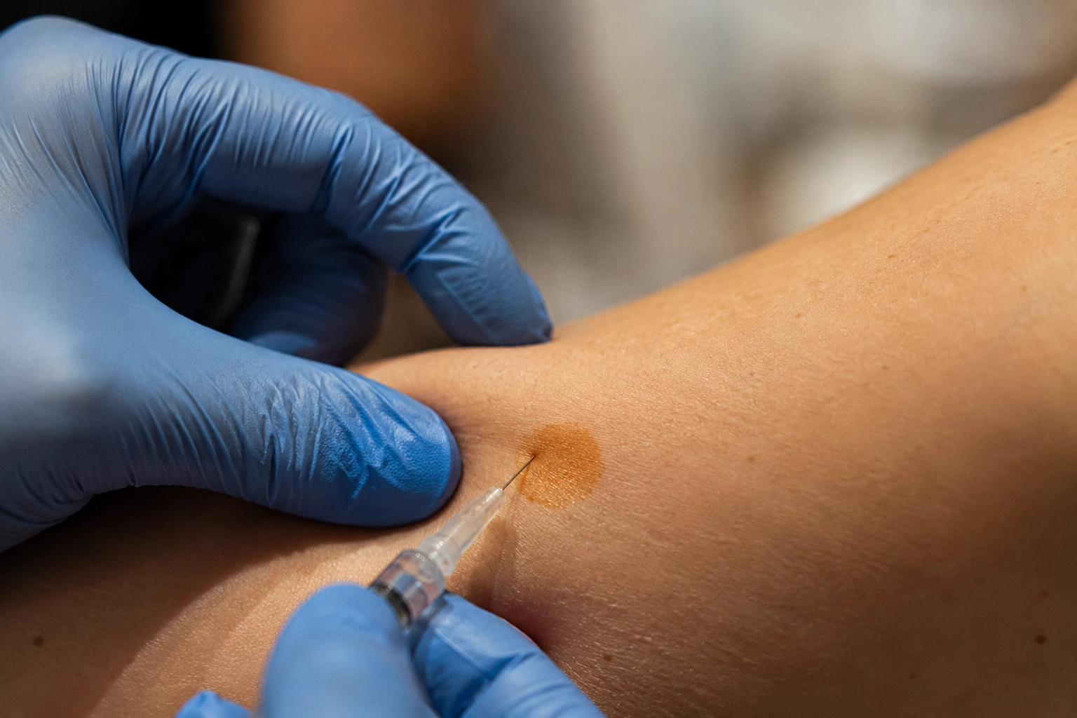 NAD+ injection at Skin Works Medical Spa