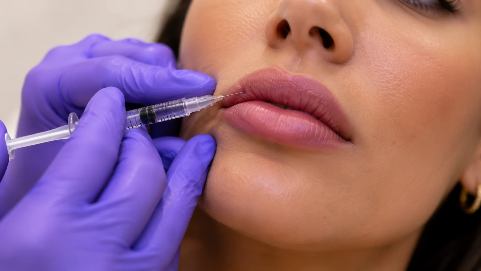 Lip filler injection closeup at Skin Works Medical Spa Torrance