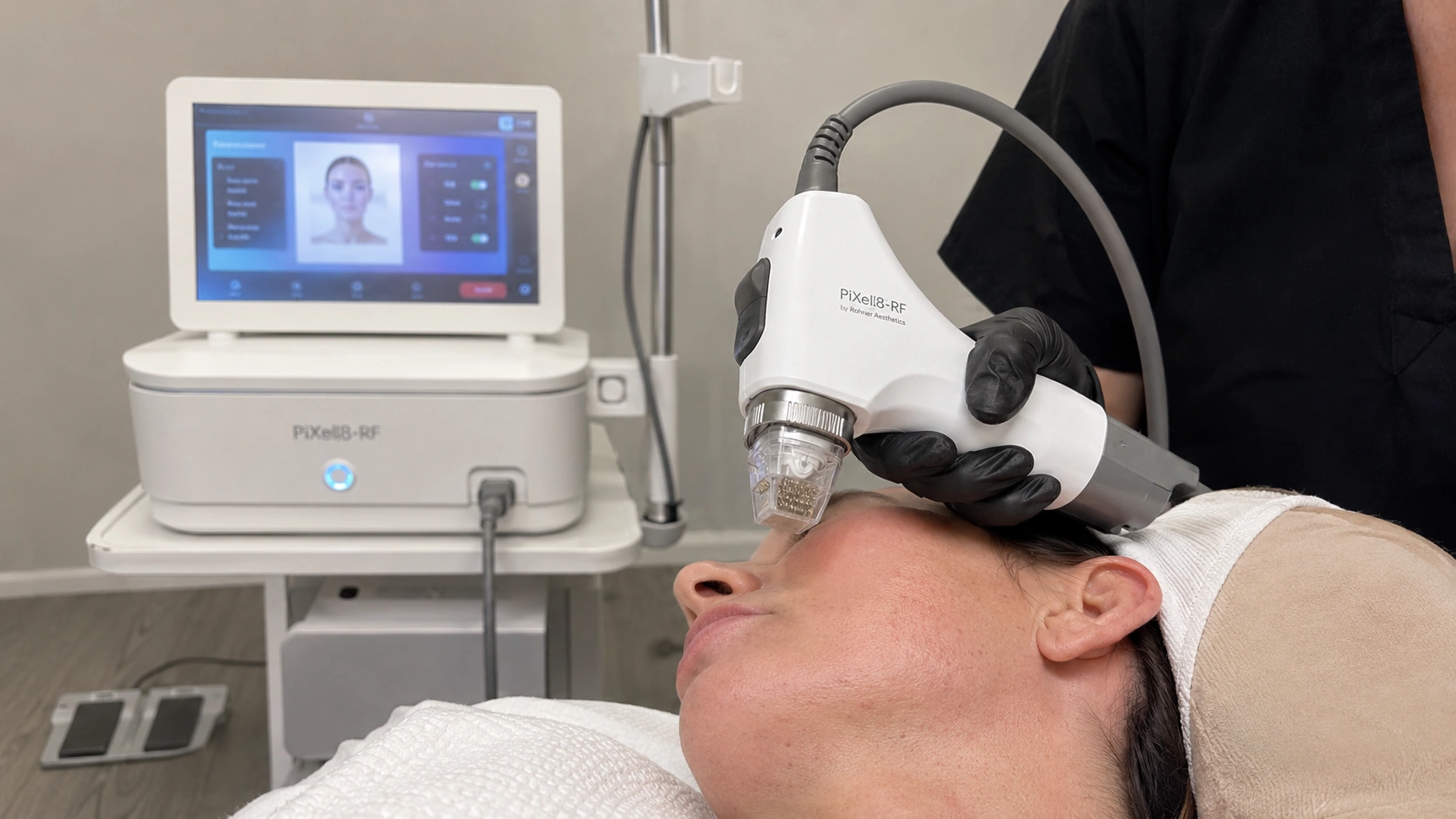Pixel8 RF microneedling handpiece and console system during treatment at Skin Works Medical Spa